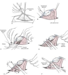 spaying