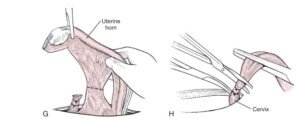 spaying